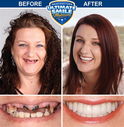 The Power of Magic Dental in Restoring Dental Health